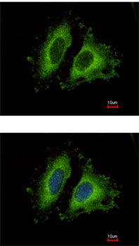 Immunocytochemistry/ Immunofluorescence - Anti-GIT1 antibody (AB153958)