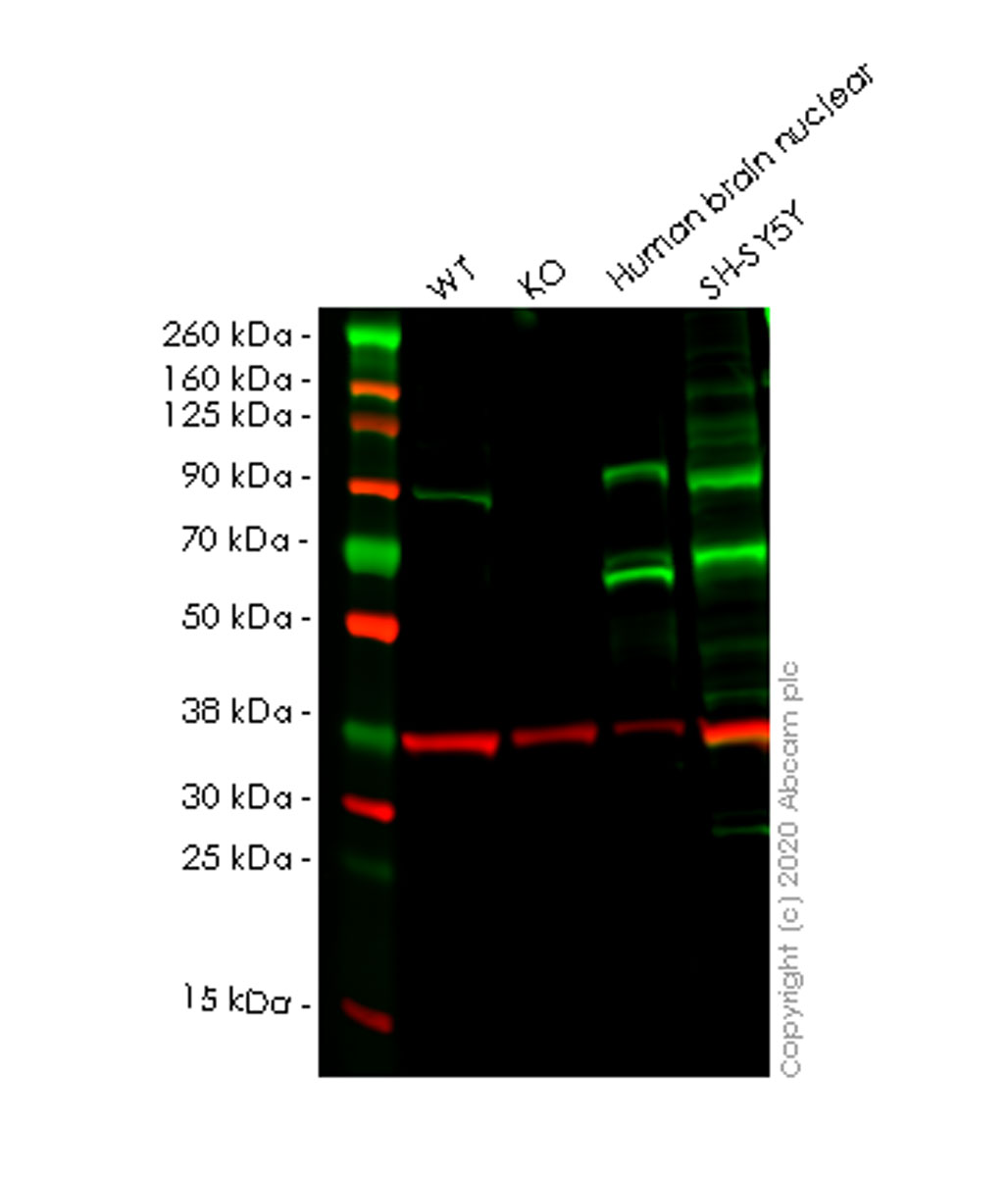 Western blot - Anti-GIT1 antibody [EPR10367] (AB156001)