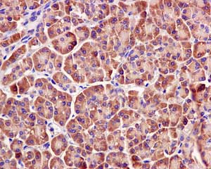 Immunohistochemistry (Formalin/PFA-fixed paraffin-embedded sections) - Anti-GIT1 antibody [EPR10368] (AB171956)