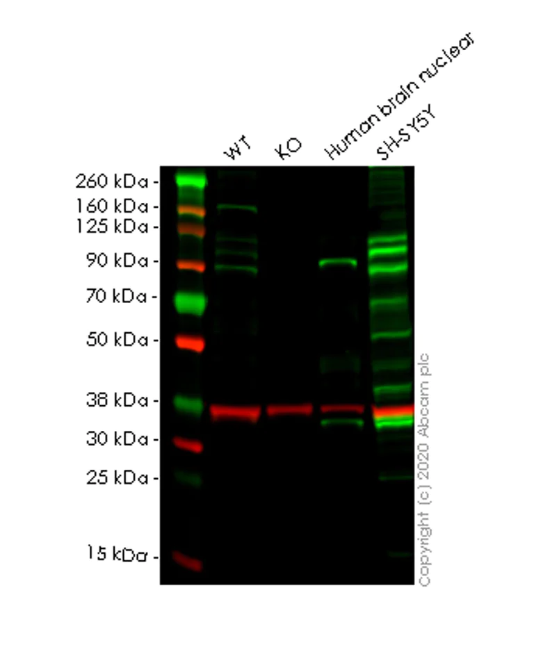 Western blot - Anti-GIT1 antibody [EPR10368] (AB171956)