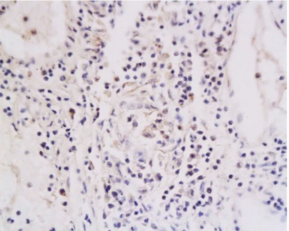 Immunohistochemistry (Formalin/PFA-fixed paraffin-embedded sections) - Anti-GITR antibody (AB203297)