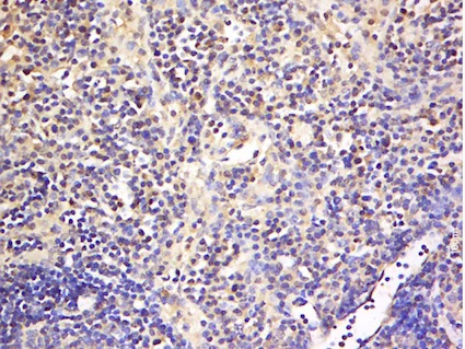 Immunohistochemistry (Formalin/PFA-fixed paraffin-embedded sections) - Anti-GITR antibody (AB203297)