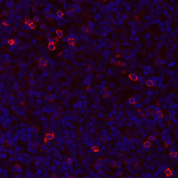 Immunohistochemistry (Formalin/PFA-fixed paraffin-embedded sections) - Anti-GITR antibody [BLR068G] - BSA free (AB264419)