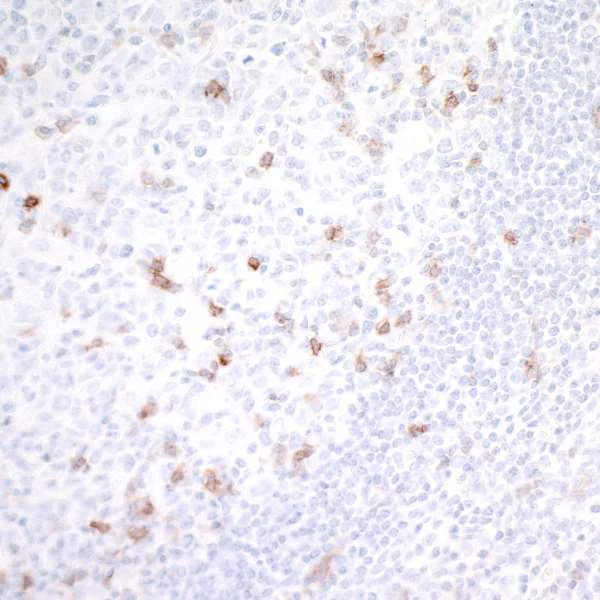 Immunohistochemistry (Formalin/PFA-fixed paraffin-embedded sections) - Anti-GITR antibody [BLR068G] - BSA free (AB264419)