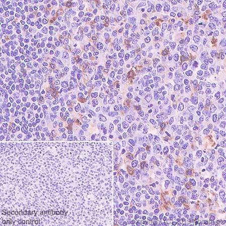 Immunohistochemistry (Formalin/PFA-fixed paraffin-embedded sections) - Anti-GITR antibody [CAL52] (AB237713)