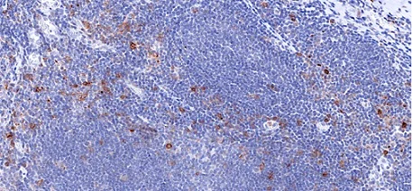 Immunohistochemistry (Formalin/PFA-fixed paraffin-embedded sections) - Anti-GITR antibody [CAL52] - BSA and Azide free (AB251600)
