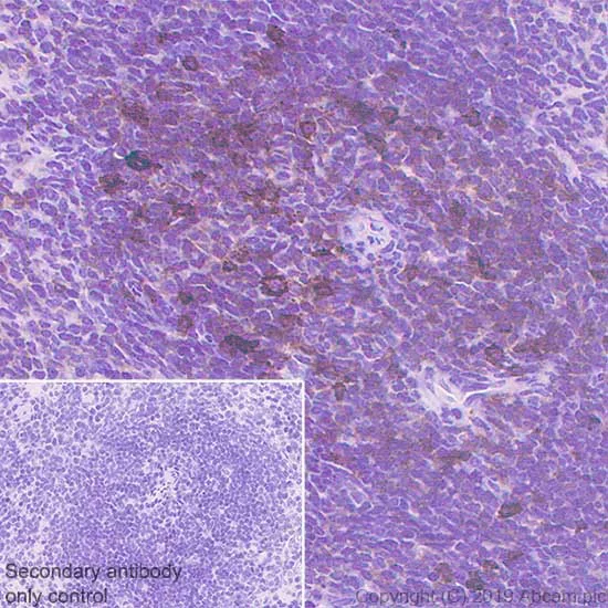 Immunohistochemistry (Formalin/PFA-fixed paraffin-embedded sections) - Anti-GITR antibody [CAL61] (AB237725)