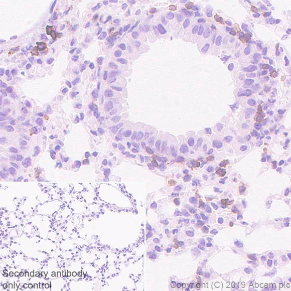 Immunohistochemistry (Formalin/PFA-fixed paraffin-embedded sections) - Anti-GITR antibody [CAL61] (AB237725)