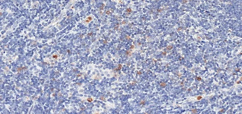 Immunohistochemistry (Formalin/PFA-fixed paraffin-embedded sections) - Anti-GITR antibody [CAL8] (AB237714)