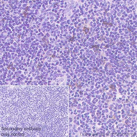 Immunohistochemistry (Formalin/PFA-fixed paraffin-embedded sections) - Anti-GITR antibody [CAL8] - BSA and Azide free (AB251601)
