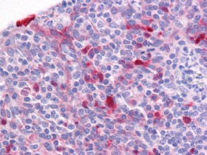 Immunohistochemistry (Formalin/PFA-fixed paraffin-embedded sections) - Anti-GIV antibody (AB113890)