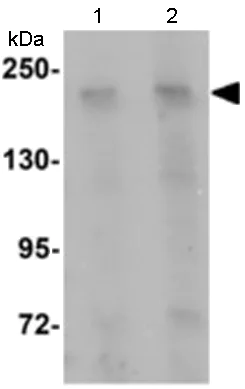 Western blot - Anti-GIV antibody (AB113890)
