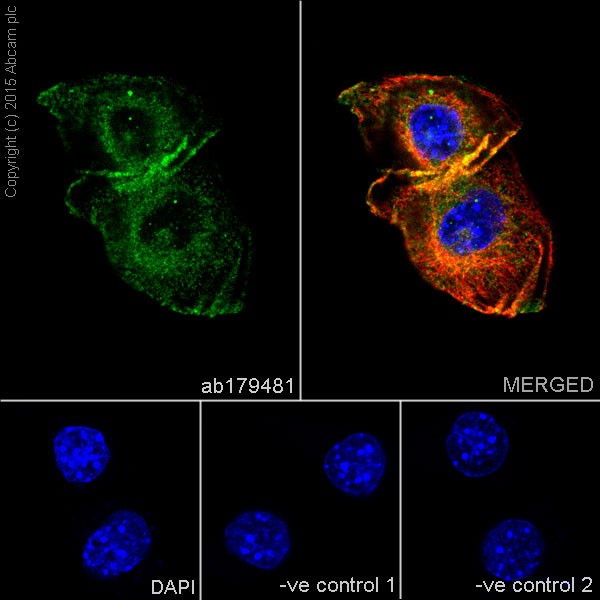 Immunocytochemistry/ Immunofluorescence - Anti-GIV antibody [EPR18433] - BSA and Azide free (ab250102), expandable thumbnail