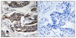 Immunohistochemistry (Formalin/PFA-fixed paraffin-embedded sections) - Anti-GIV (phospho S1417) antibody (AB111440)