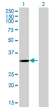Western blot - Anti-GIYD2 antibody (AB68807)