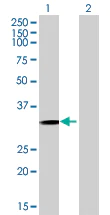 Western blot - Anti-GIYD2 antibody (AB68807)