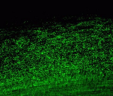 Immunohistochemistry (Formalin/PFA-fixed paraffin-embedded sections) - Anti-GJA3/Cx46 antibody [11H16L33] - Intercellular Junction Marker (AB203564), expandable thumbnail