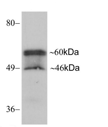 Western blot - Anti-GJA3/Cx46 antibody [11H16L33] - Intercellular Junction Marker (AB203564), expandable thumbnail