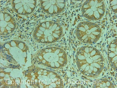 Immunohistochemistry (Formalin/PFA-fixed paraffin-embedded sections) - Anti-GJB2 antibody (AB65969)