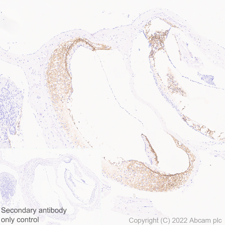 Immunohistochemistry (Formalin/PFA-fixed paraffin-embedded sections) - Anti-GJB2 antibody [EPR26418-19] - BSA and Azide free (ab303499), expandable thumbnail