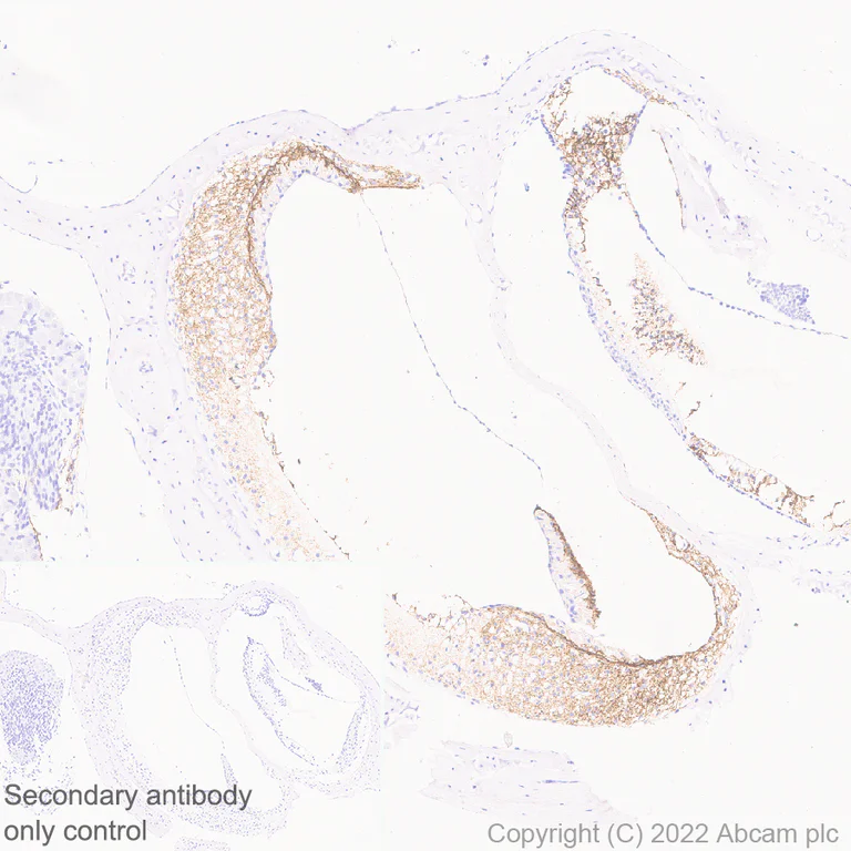 Immunohistochemistry (Formalin/PFA-fixed paraffin-embedded sections) - Anti-GJB2 antibody [EPR26418-19] - BSA and Azide free (AB303499)