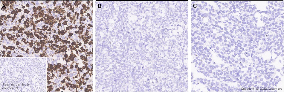 Immunohistochemistry (Formalin/PFA-fixed paraffin-embedded sections) - Anti-GJB2 antibody [EPR26418-19] - BSA and Azide free (AB303499), expandable thumbnail