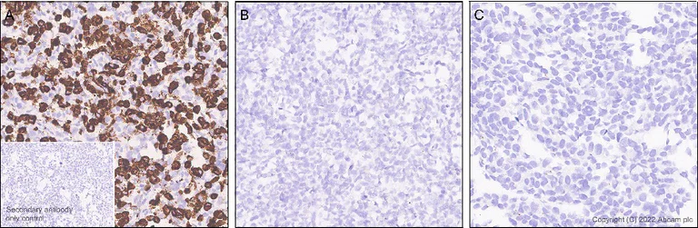 Immunohistochemistry (Formalin/PFA-fixed paraffin-embedded sections) - Anti-GJB2 antibody [EPR26418-19] - BSA and Azide free (AB303499)
