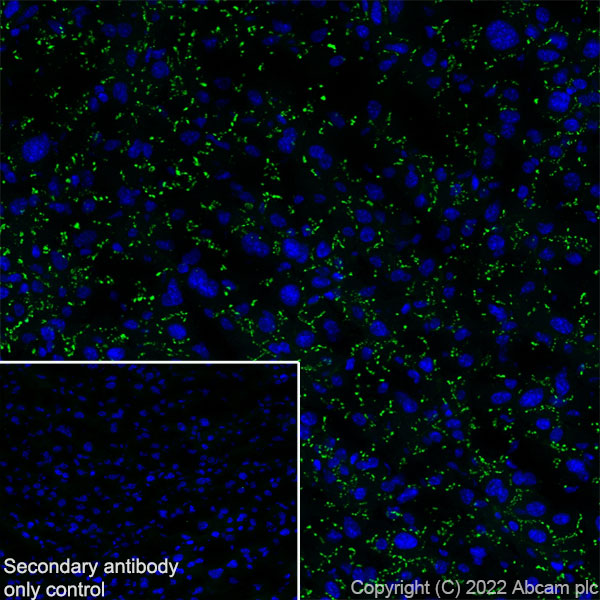 Immunohistochemistry (Frozen sections) - Anti-GJB2 antibody [EPR26418-19] - BSA and Azide free (AB303499), expandable thumbnail