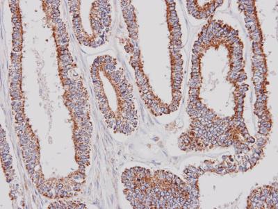 Immunohistochemistry (Formalin/PFA-fixed paraffin-embedded sections) - Anti-GK2 antibody (AB153926), expandable thumbnail
