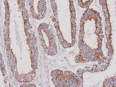 Immunohistochemistry (Formalin/PFA-fixed paraffin-embedded sections) - Anti-GK2 antibody (AB153926)