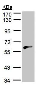 Western blot - Anti-GK2 antibody (AB153926), expandable thumbnail