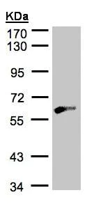 Western blot - Anti-GK2 antibody (AB153926)