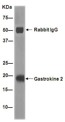 Immunoprecipitation - Anti-GKN2 antibody [EPR15377(B)] - BSA and Azide free (AB232624)