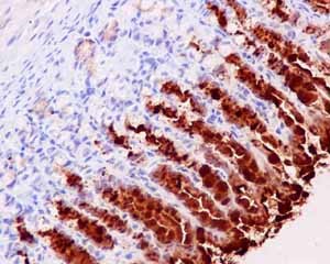 Immunohistochemistry (Formalin/PFA-fixed paraffin-embedded sections) - Anti-GKN2 antibody [EPR15377(B)] - C-terminal (AB188866), expandable thumbnail
