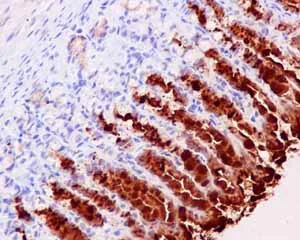 Immunohistochemistry (Formalin/PFA-fixed paraffin-embedded sections) - Anti-GKN2 antibody [EPR15377(B)] - C-terminal (AB188866)