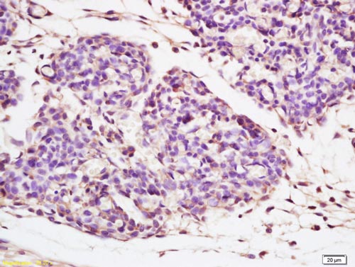 Immunohistochemistry (Formalin/PFA-fixed paraffin-embedded sections) - Anti-GLB1/Beta-galactosidase antibody (AB203749), expandable thumbnail