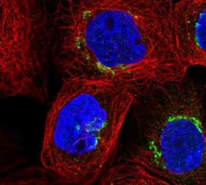 Immunocytochemistry/ Immunofluorescence - Anti-GLB1/Beta-galactosidase antibody (AB220283)