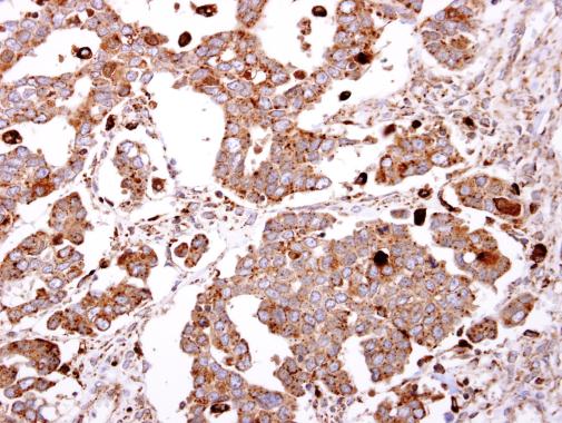 Immunohistochemistry (Formalin/PFA-fixed paraffin-embedded sections) - Anti-GLB1/Beta-galactosidase antibody (AB96239), expandable thumbnail