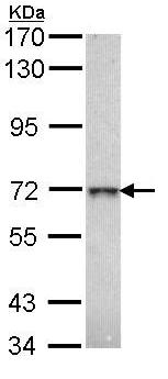 Western blot - Anti-GLB1/Beta-galactosidase antibody (AB96239), expandable thumbnail