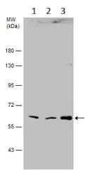 Western blot - Anti-GLB1/Beta-galactosidase antibody (AB96239)