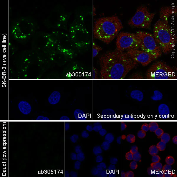 Immunocytochemistry/ Immunofluorescence - Anti-GLB1/Beta-galactosidase antibody [EPR26120-76] (AB305174)