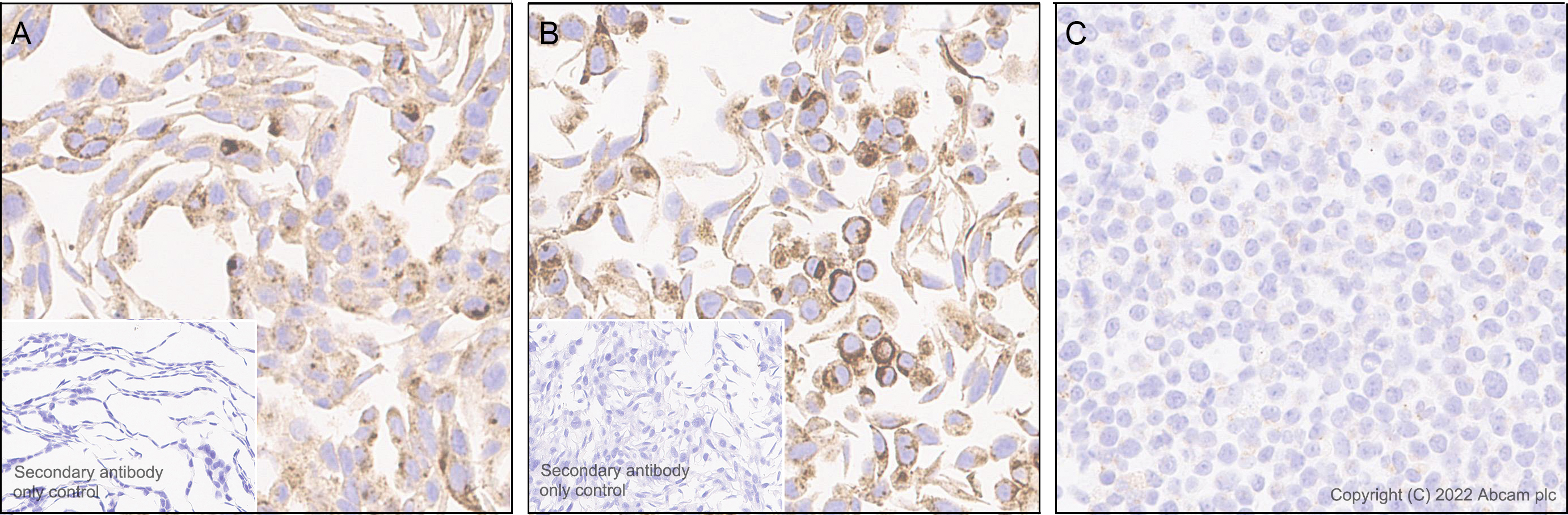 Immunohistochemistry (Formalin/PFA-fixed paraffin-embedded sections) - Anti-GLB1/Beta-galactosidase antibody [EPR26120-76] (ab305174), expandable thumbnail