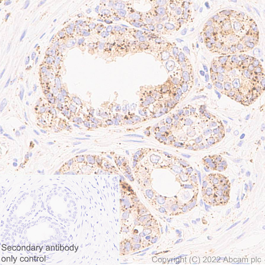 Immunohistochemistry (Formalin/PFA-fixed paraffin-embedded sections) - Anti-GLB1/Beta-galactosidase antibody [EPR26120-76] (ab305174), expandable thumbnail