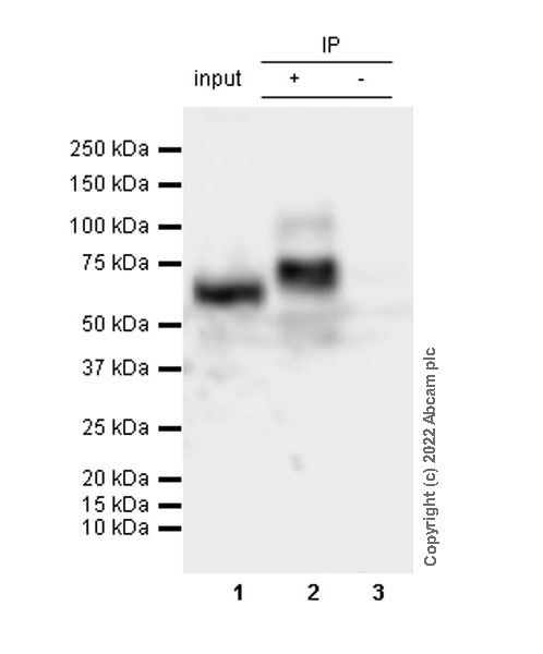 Immunoprecipitation - Anti-GLB1/Beta-galactosidase antibody [EPR26120-76] (AB305174), expandable thumbnail