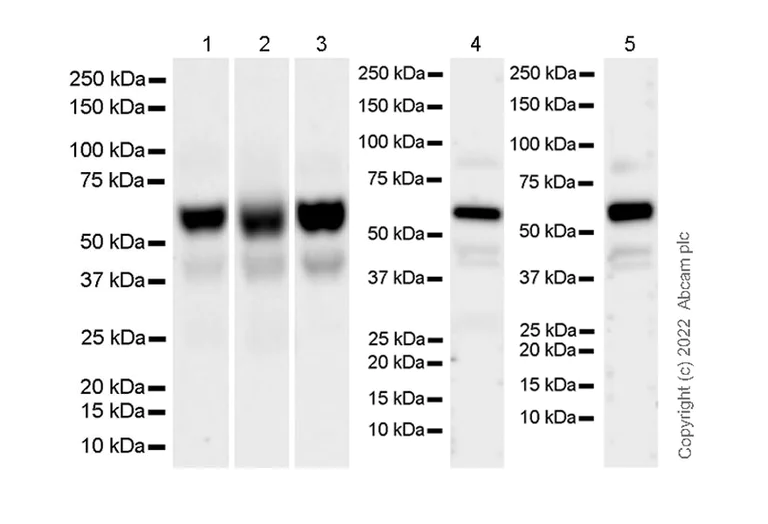 Western blot - Anti-GLB1/Beta-galactosidase antibody [EPR26120-76] (AB305174)