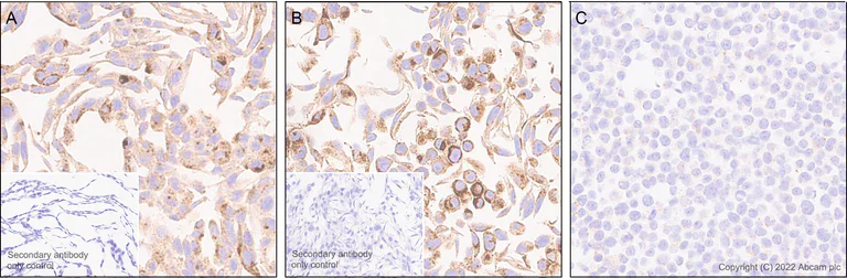Immunohistochemistry (Formalin/PFA-fixed paraffin-embedded sections) - Anti-GLB1/Beta-galactosidase antibody [EPR26120-76] - BSA and Azide free (AB305175)