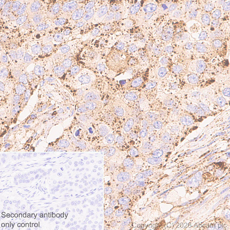 Immunohistochemistry (Formalin/PFA-fixed paraffin-embedded sections) - Anti-GLB1/Beta-galactosidase antibody [EPR26120-76] - BSA and Azide free (AB305175)