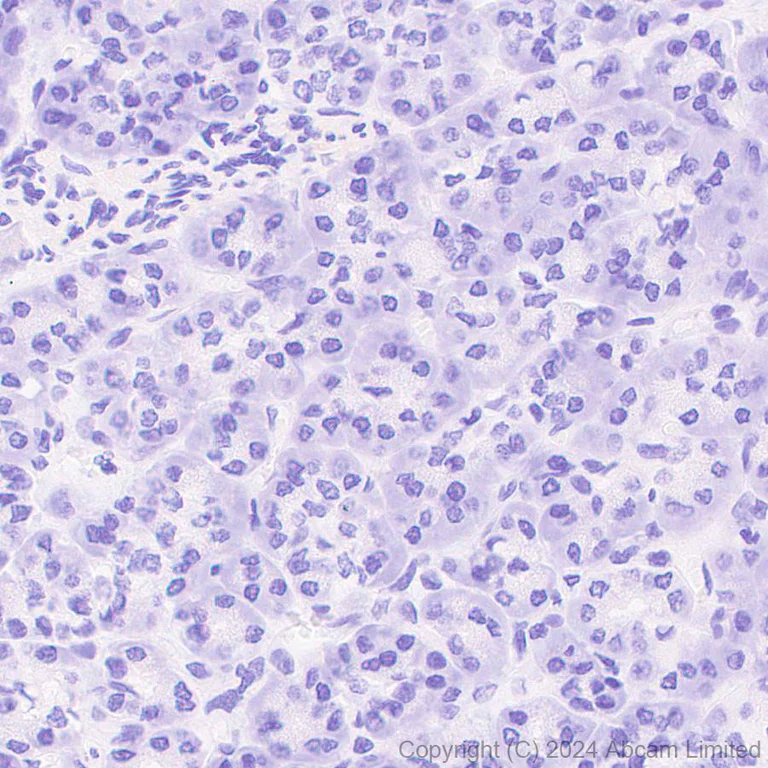 Immunohistochemistry (Formalin/PFA-fixed paraffin-embedded sections) - Anti-GLEPP1/PTPRO antibody [EPR28645-553] (AB322047)