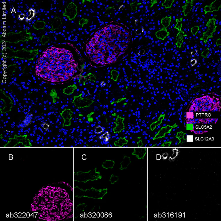 Multiplex immunohistochemistry - Anti-GLEPP1/PTPRO antibody [EPR28645-553] (AB322047)