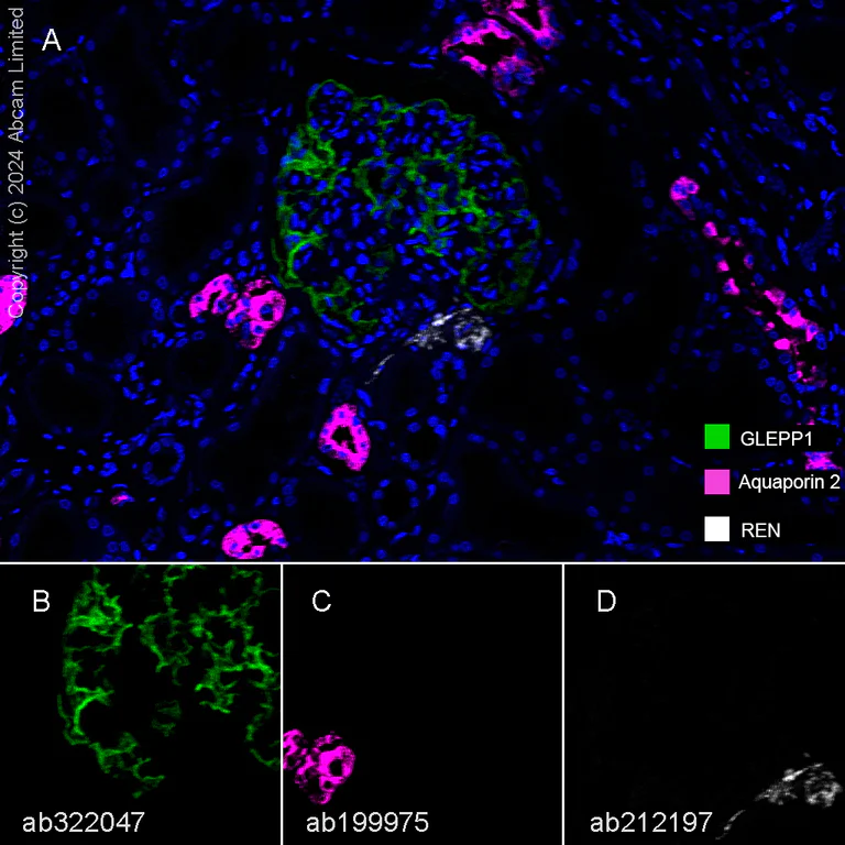 Multiplex immunohistochemistry - Anti-GLEPP1/PTPRO antibody [EPR28645-553] (AB322047)
